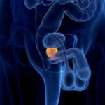 Koliko Traje Oporavak Nakon Operacije Prostate: Realna Iskustva i Kompletan Vodič