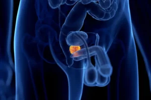 Read more about the article Koliko Traje Oporavak Nakon Operacije Prostate: Realna Iskustva i Kompletan Vodič