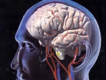 Read more about the article Benigna intrakranijalna hipertenzija – sve što trebate znati