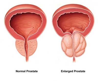 Prostate funkcija