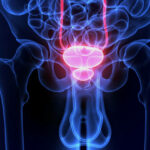 Rak prostate simptomi i rani znakovi koje ne smijete ignorirati