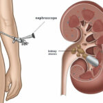 Bubrezi gdje se nalaze – Kompletan anatomski vodič