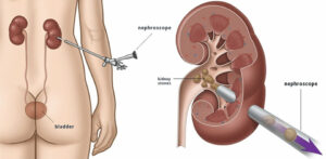 Read more about the article Bubrezi gdje se nalaze – Kompletan anatomski vodič