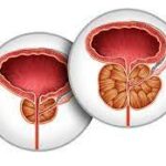 Prostate funkcija u tijelu muškarca i najčešći poremećaji