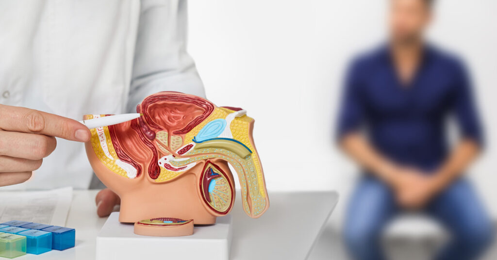 benign prostate enlargement